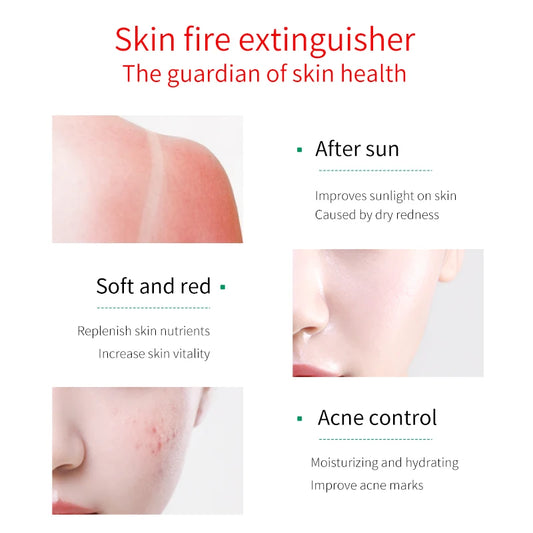 FONCE Organic Pure Aloe Vera Gel 300g Moisturizing Cream Sunburn Aloe Gel Natural Safe Sleeping Mask Soothing Lotion