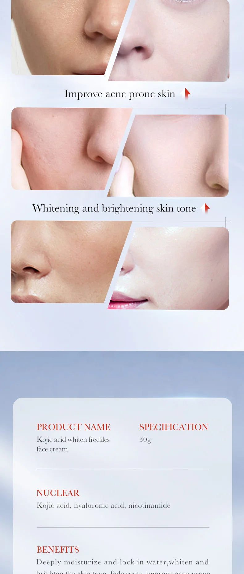 1/2pcs SADOER Kojic Acid Face Cream Moisturizing Freckle Removing Creams Brightening Hydrating Facial Cream Skin Care Products
