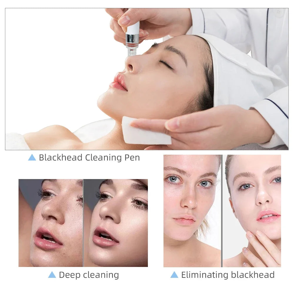 Missheart Professional Beauty Facial Machine  Hydra Aqua Deep Cleaning Skin Care Device（ EU /UK /US Fast Shipping）